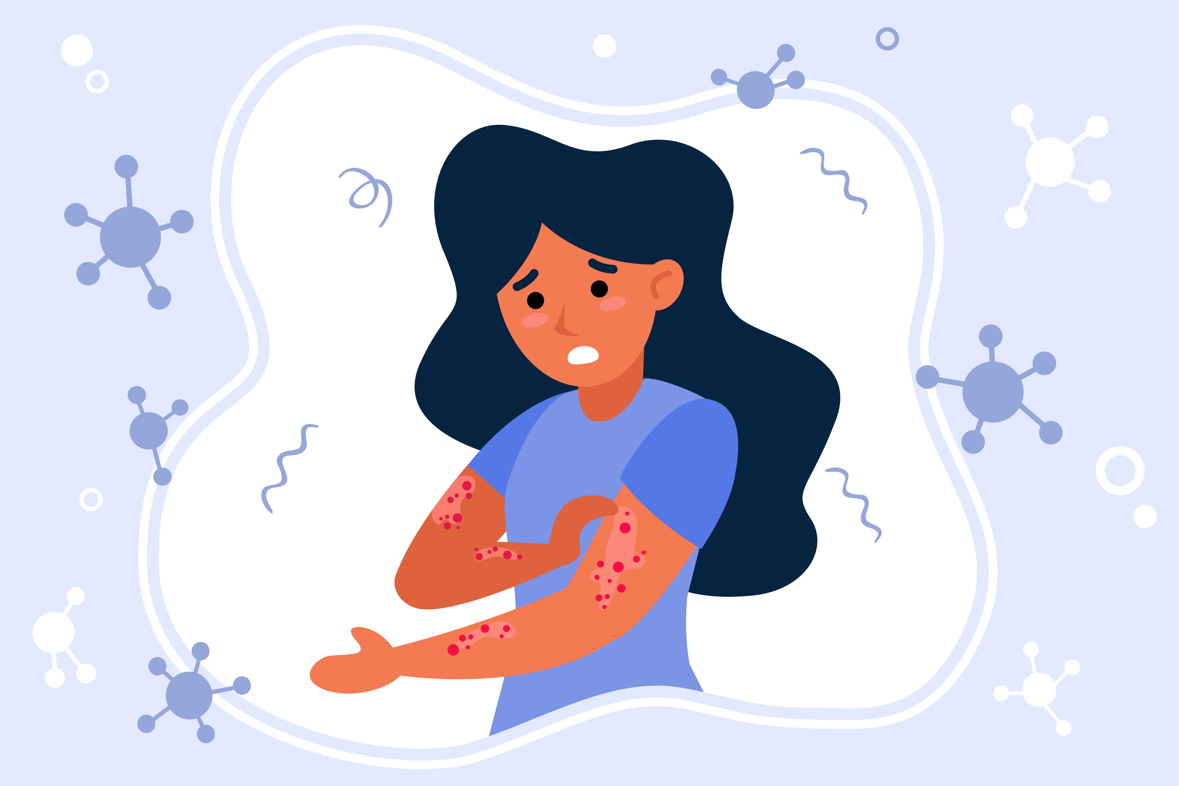 Skin Diseases